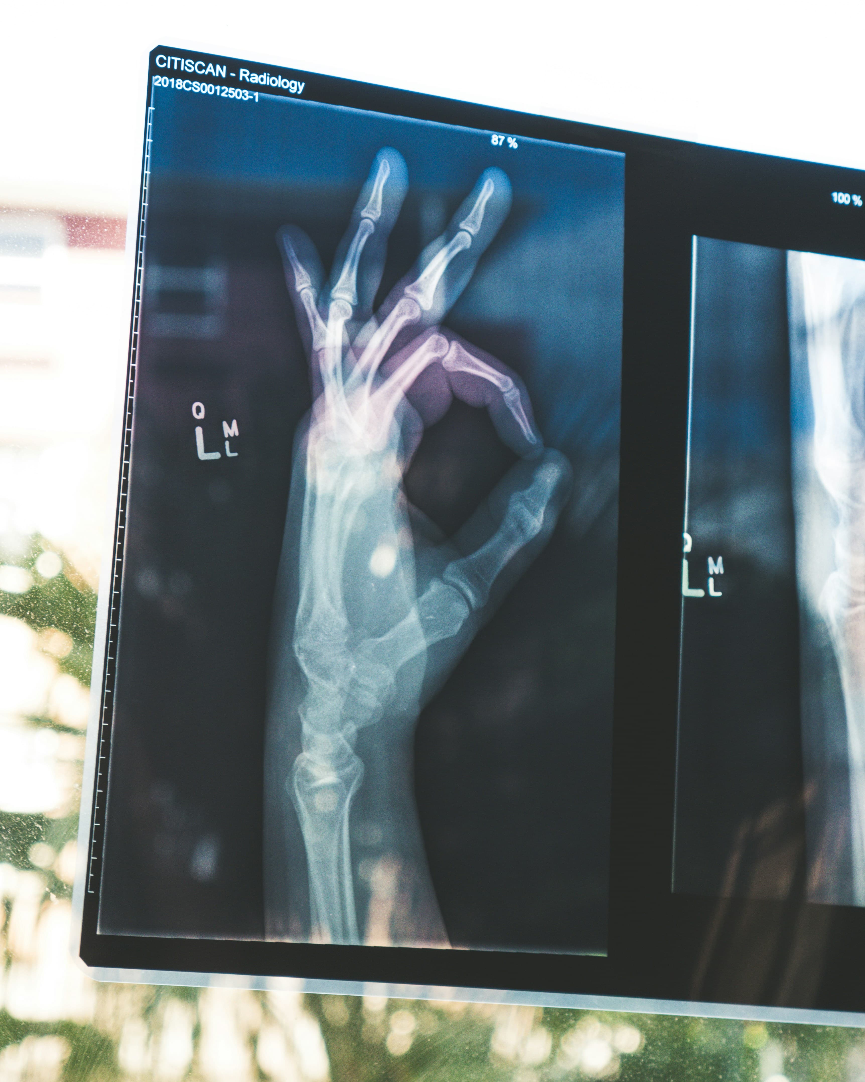 AI in Radiology: The Future Is Now